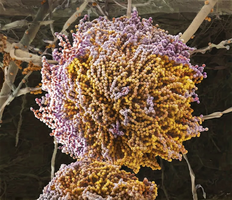 Aspergillus plijesan