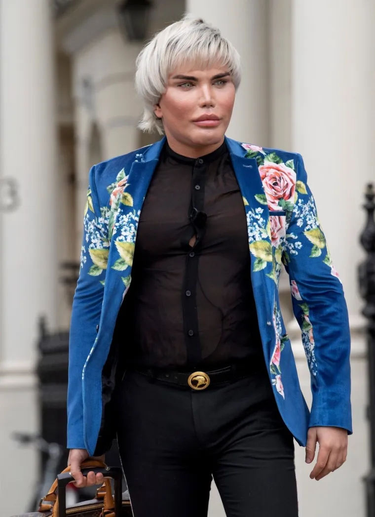 Iako je često na meti kritika zbog svoje transformacije, Jessica se zalaže za pravo svake osobe da oblikuje vlastiti izgled i život.  
