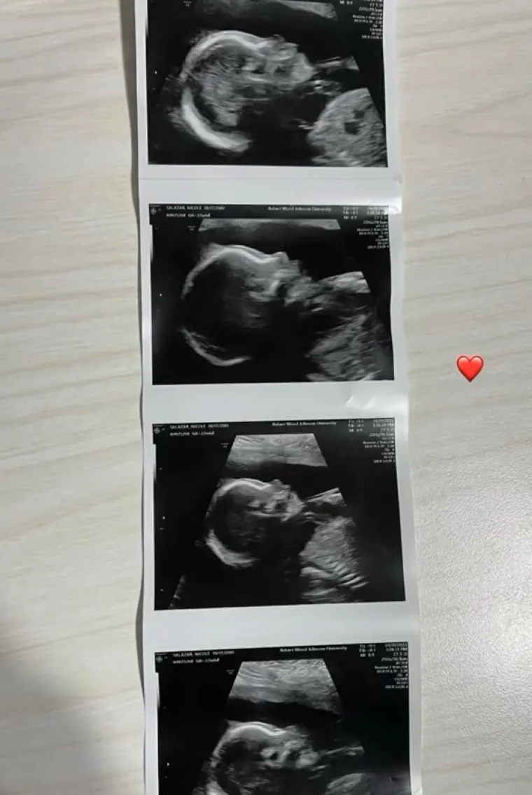 A sve su to, uostalom, potvrđivale i fotografije s ultrazvuka.