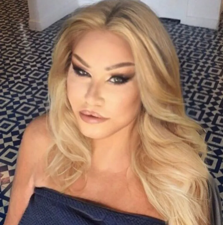 Estetski zahvati su je unakazili: Ovako je 'Žena mačka' izgledala prije operacija