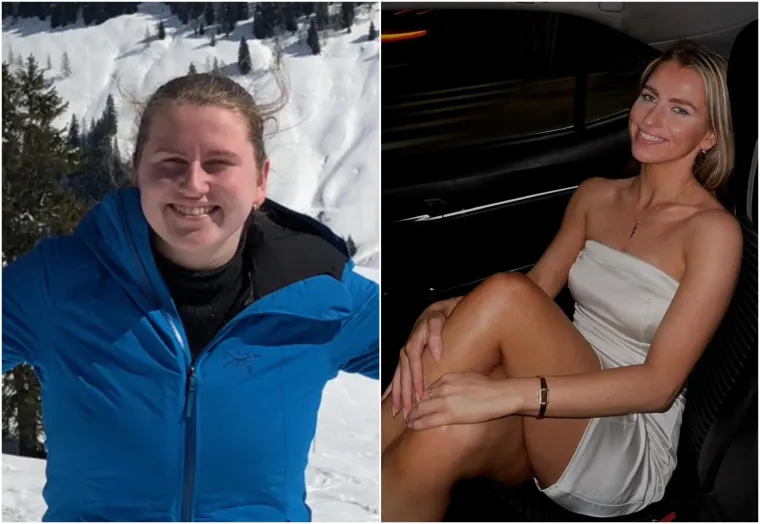 Korisnica Reddita KolaWolf: Na fotografiji lijevo sa 17 godina, na fotografiji desno s 23 godine