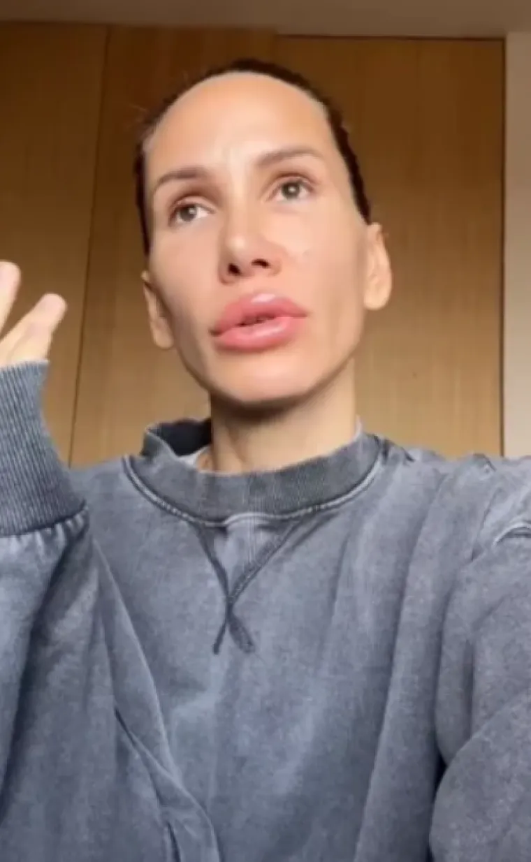 Kako je rekla u jednom intervjuu za Blic, prvi zahvat kojem se podvrgnula bila je augmentacija grudi.
