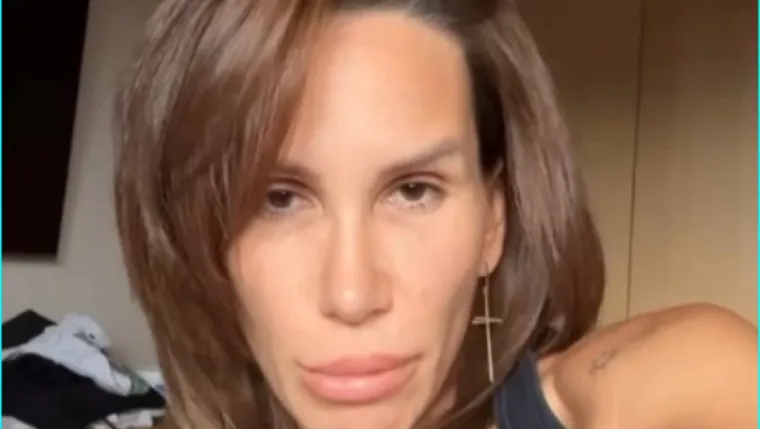 Tako je jednom na društvenim mrežama objavila video bez šminke, gdje je pokazala prirodan izgled i njegovanu kožu, naglašavajući kako je botoks koristila u umjerenim količinama.