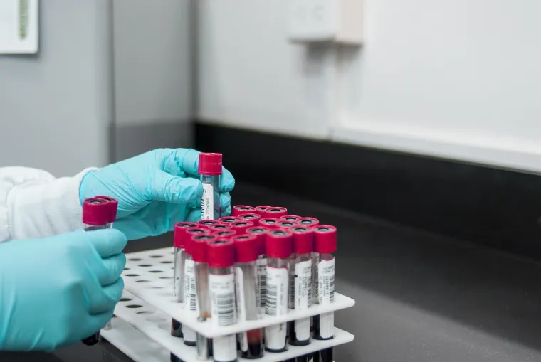 Testom krvi može se odrediti krvna grupa pojedinca. U laboratorijskim uvjetima krv se kombinira s tri tvari i onda se promatraju reakcije. Te tvari uključuju antitijela za A ili B krvnu grupu, kao i Rh faktor. Analizirajući te reakcije, tehničar može točno identificirati krvnu grupu osobe.