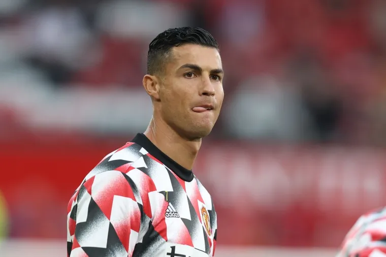 Ni Ronaldo nije zaobišao kirurge: Evo kako je nogometna legenda izgledala prije operacija