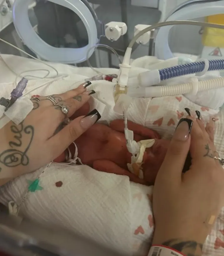 Ostatak njene trudnoće odvijao se glatko, sve dok prerano nije rodila svoju kćer Romy-Rae koja je bila teška samo kilogram. Mala mrvica borila se za život na intenzivnoj njezi, gdje je provela 80 dana. Unatoč svom teškom početku života, Romy-Rae sada ima jednu godinu te sjajno napreduje, a brižna mama zove je svojim &quot;malim čudom&quot; koje je svaki dan ugodno iznenadi s nečim novim.