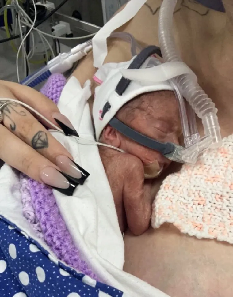&quot;Bilo je to najteže razdoblje u mom životu. Tijekom cijele trudnoće krvarila sam, što je bilo zastrašujuće. U bolnici su mi tri puta rekli da je moja beba preminula prije nego što su me uopće ultrazvučno pregledali, zbog količine krvi koju sam gubila, tada sam bila deset tjedana trudna. Bilo je to užasno čuti, apsolutno pogubno za dušu&quot;, ispričala je Geriiee za NeedToKnow.