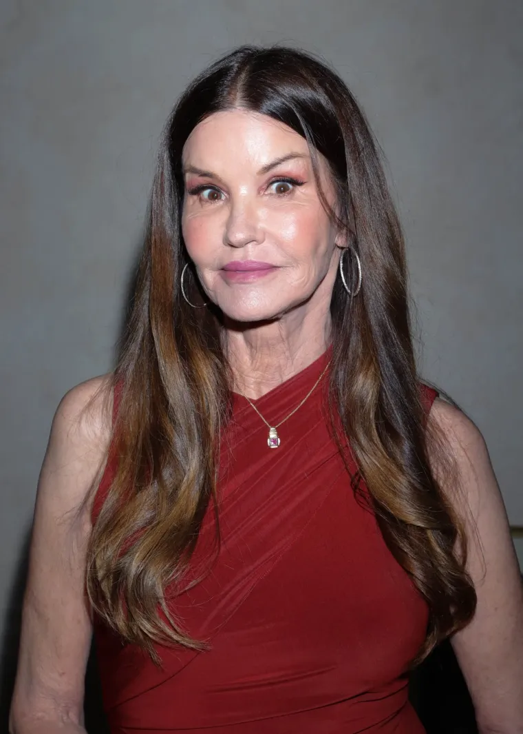 Zbog plastičnih operacija upala u dugove: Nekad lijepa manekenka unakazila je lice i tijelo