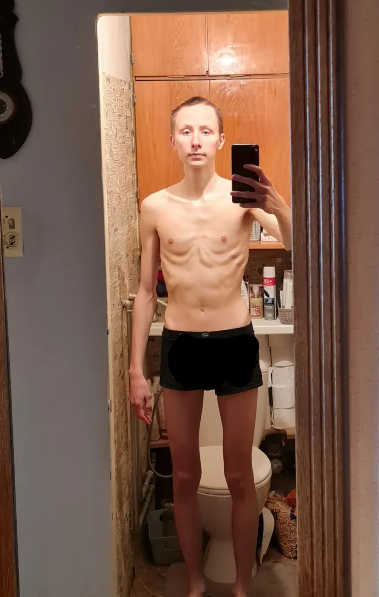 Isti odgovor ponudit će vam i korisnik vonn29. Od neuhranjenog dečka (21) koji se sramio skinuti na plaži..