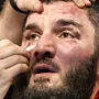 Artur Beterbijev u svom kutu sanira ozljede. 
