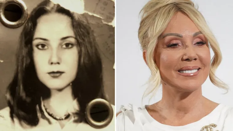 Lepa Brena, pravim imenom Fahreta Jahić Živojinović, jedna je od najpoznatijih i najutjecajnijih pjevačica Balkana, zvali su je &quot;Noge Jugoslavije&quot; te je bila san većine muškaraca tog vremena. Kako je izgledala prije većih estetskih intervencija pogledajte u nastavku.