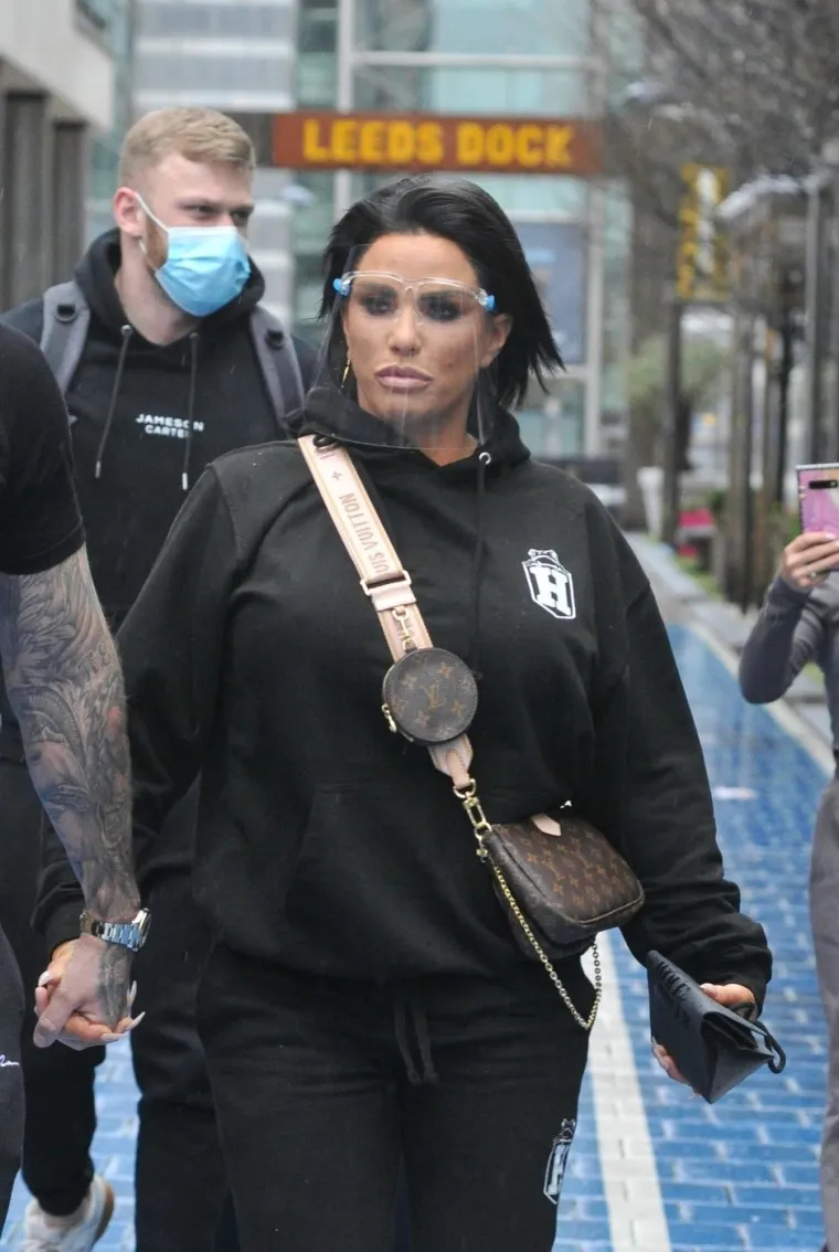 Nekad zgodna plavu&scaron;ica sada je plastična crnka: Operacije je uni&scaron;tile, evo kako se mijenjala