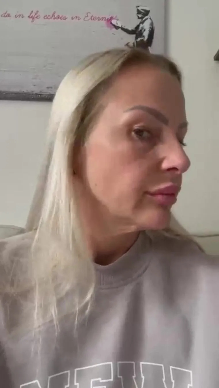 Unatoč svemu, Leanne je ostala pri svojoj odluci i podvrgnula se liftingu lica. 