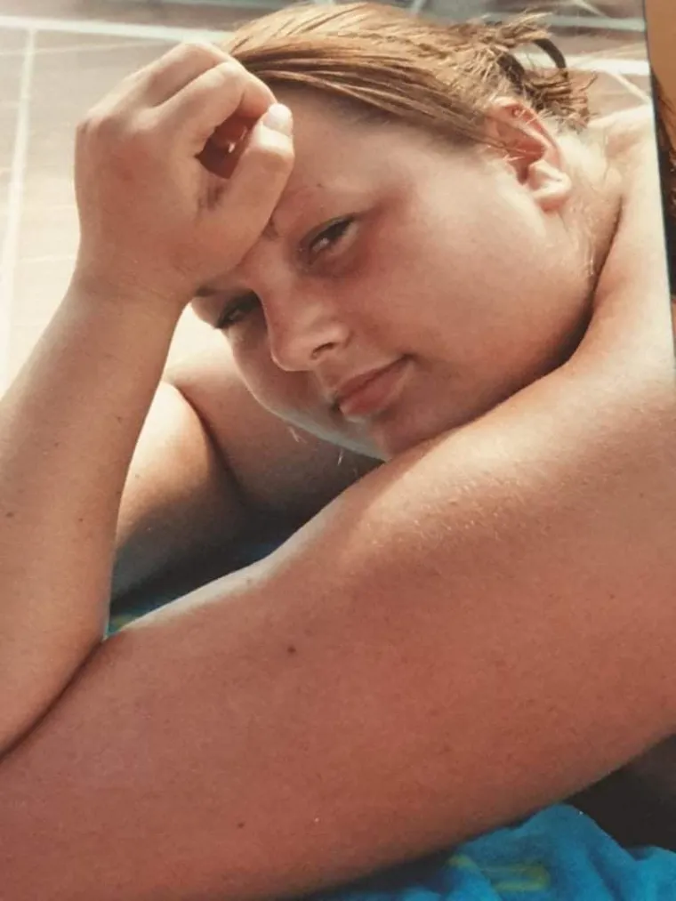 Jedni od njih su dermalni fileri na bazi hijaluronske kiseline (kao &scaron;to su Juvederm i Restylane) mogu se koristiti za nadoknadu izgubljenog volumena, popunjavanje bora i pobolj&scaron;anje kontura lica. Rezultati su privremeni, obično traju 6-18 mjeseci.