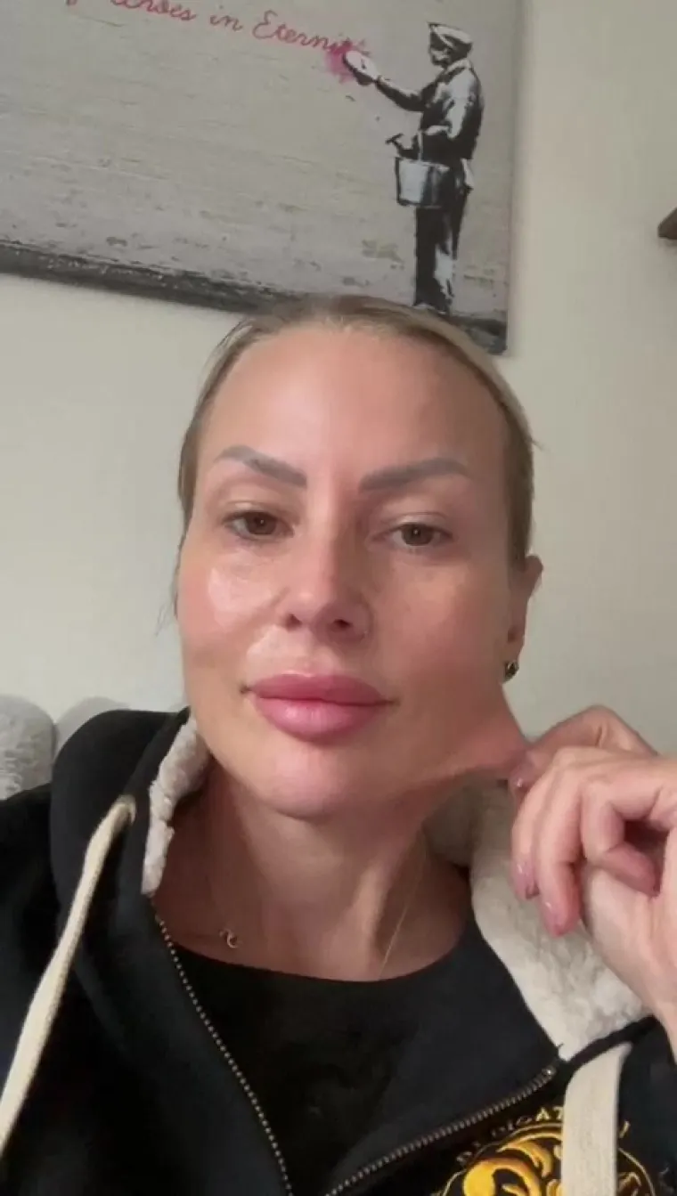 Lasersko obnavljanje kože uključuje različite vrste lasera (ablativni i neablativni) koji se mogu koristiti za pobolj&scaron;anje teksture kože, smanjenje bora, ublažavanje ožiljaka i pigmentacija.