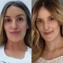&quot;Fotografija s lijeve strane snimljena je prije dvije velike operacije – čeljusti i nosa. Oduševljena sam kako počinjem izgledati izvana, baš onako kako se osjećam iznutra. Ovo je definitivno moja najbolja transformacija dosad&quot;, napisala je Marina ranije na Instagramu.
