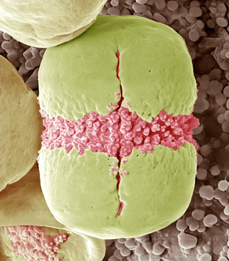 20. Pelud potočnice: Poznata kao nezaboravak (Myosotis), ova biljka dolazi iz porodice boražinovki. Raste na vlažnim, polusjenovitim i hladnim mjestima, a voli i hranjiva, svježa i dobro drenirana tla. Na fotografiji se vidi peludno zrno koje sadrži mu&scaron;ku reproduktivnu stanicu koja je namijenjena oplodnji jajne stanice i pokreće formiranje sjemena za novu biljku. 