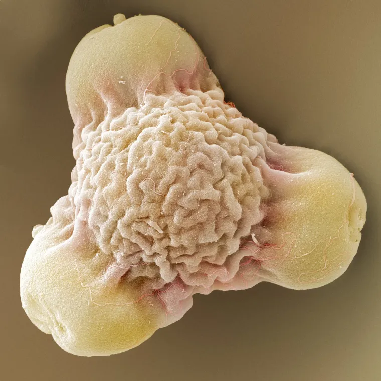 21. Pelud dvogodi&scaron;nje pupoljke: Raste uz rijeke i jezera, ali i na svježe prekopanom tlu od kraja proljeća do kasnog ljeta. Na fotografiji je prikazano peludno zrno dvogodi&scaron;nje pupoljke (Oenothera biennis). Peludna zrnca su mu&scaron;ke spolne stanice biljke.