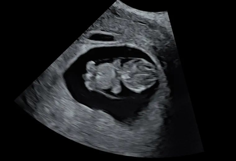 Udomili 17 djece i posvojili četvero, a sada je trudna: 'Ovo je ostvarenje sna!'