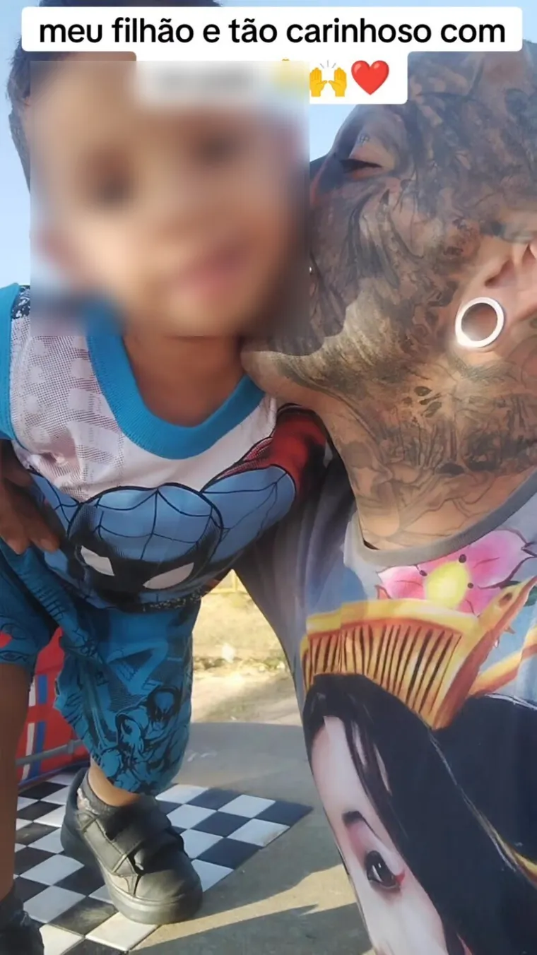 Iako je kroz godine dobivao brojne reakcije, mnoge od njih bile su negativne. Pedro priznaje kako ga ljudi često osuđuju na prvu, bez da ga upoznaju.