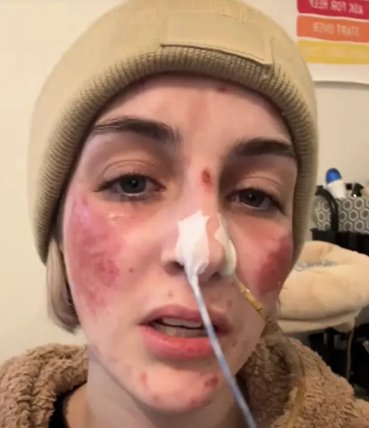 Trpi strašne bolove, a nitko ne zna zašto: 'Bilo da se smijem ili plačem, moja koža gori'