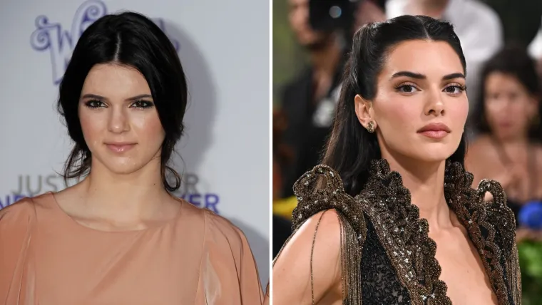 Kendall Jenner rođena je 3. studenog 1995. u Los Angelesu, kao kći Caitlyn Jenner (tada Brucea) i Kris Jenner. Njezina majka prije Jennera bila je udana za Roba Kardashiana s kojim je dobila popularne sestre Kim, Kourtney i Khloe. Kendall slovi za najprirodniju od svih sestara, od kojih oba roditelja dijeli samo s Kylie, međutim, fotografije pokazuju da je i ona pametno investirala u svoj izgled te postigla drastične promjene.