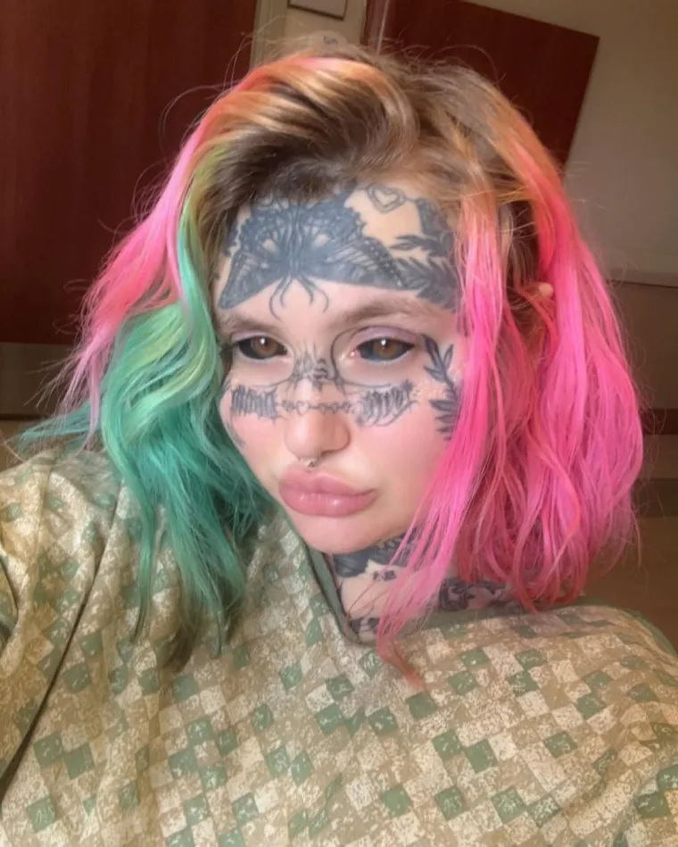 &quot;Kad mi je jezik zacijelio, odmah sam probala. Uzela sam Coca-Colu i Sprite. Bila sam zbunjena okusom, osjećala sam ih odvojeno&quot;, rekla je. 