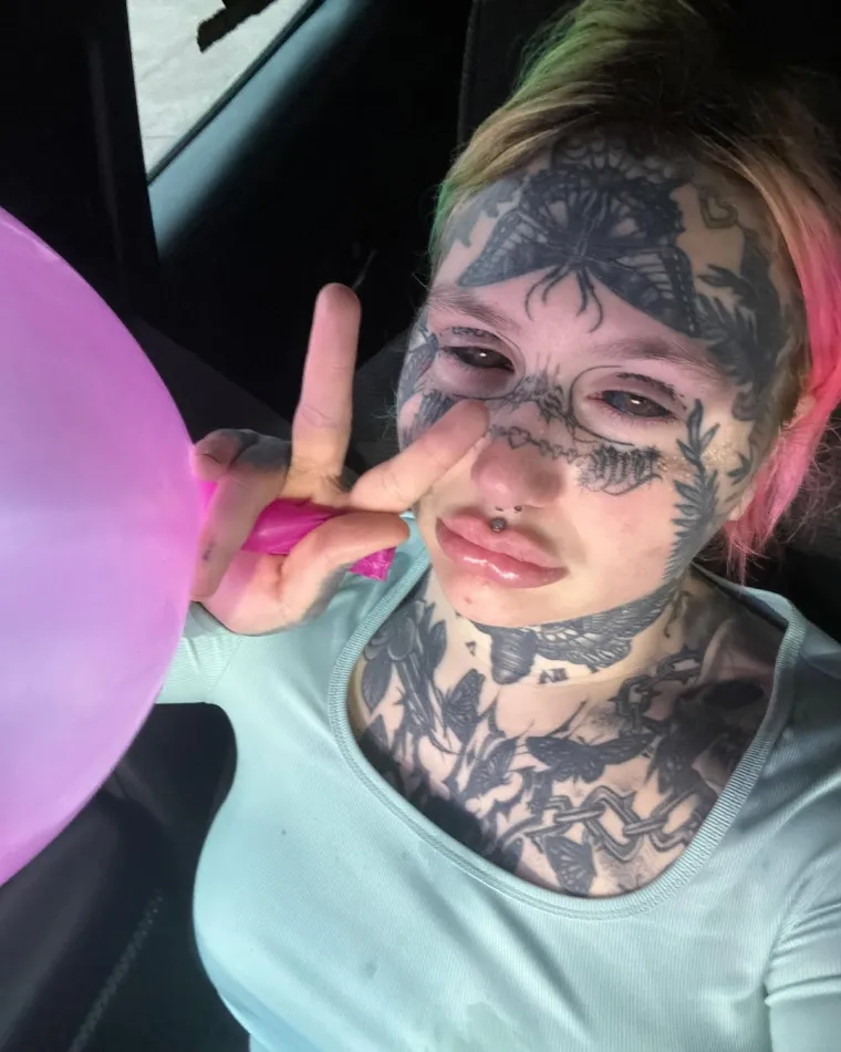 Ova intervencija ju je, kaže, koštala samo 550 funti, odnosno oko 646 eura, a proces je uključivao lokalnu anesteziju i šivanje jezika nakon što je podijeljen na dva dijela.