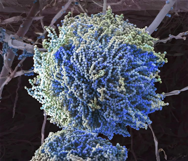 Aspergillus plijesan