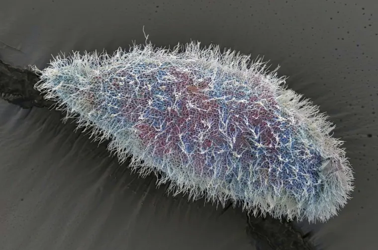 Paramecium protozoa (papučica).