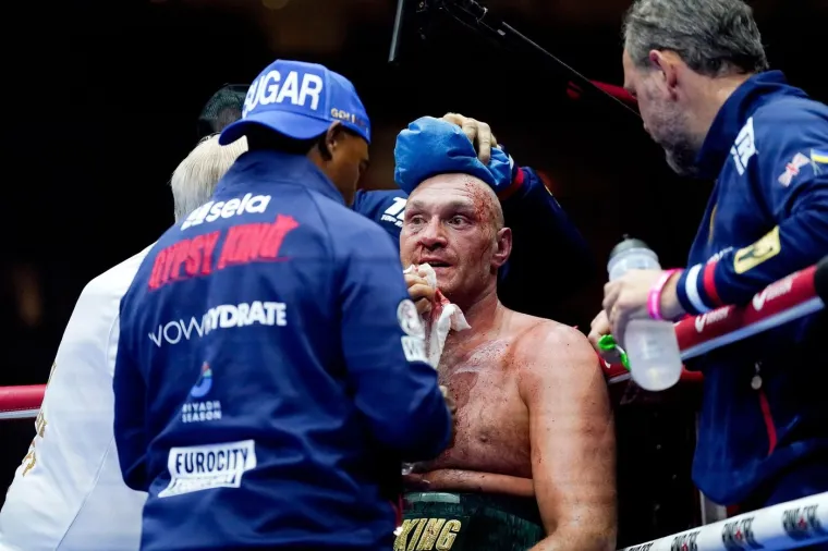 Usyk je toliko jako udario Furyja da su gorostasu zaklecala koljena: Publika gledala u nevjerici