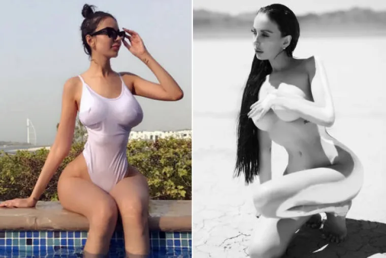 GUZU NAPUMPALA S PREKO 2 LITRE MASTI: Brazilka želi postati kao Kim Kardashian i u to je uložila skoro pola milijuna dolara