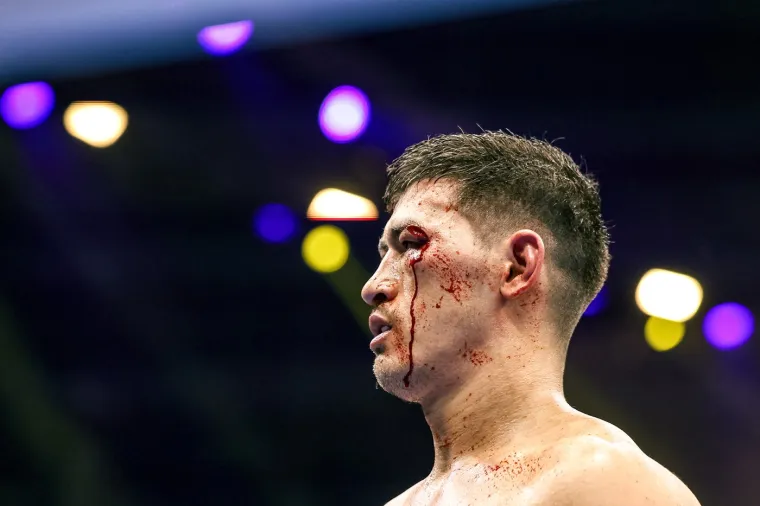 Dmitrij Bivol je uz Oleksandr Usyka najbolji boksač današnjice, neprikosnoveni vladar ringa u poluteškoj diviziji svjetskog boksa. 
