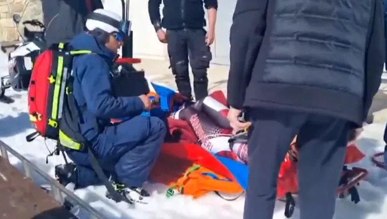 Stravičan pad najbolje skijašice svijeta: Pogledajte scene višestrukog prijeloma noge