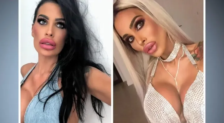 PRELETJELA POLA SVIJETA JER ŽELI JOŠ VEĆE GRUDI: Vidite li zašto joj ih liječnici ne žele napraviti?
