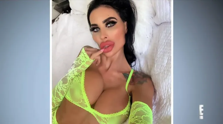 Australka Tara Jayne obratila se timu plastičnih kirurga iz emisije "Botched" u nadi da će dobiti veće grudi no odgovori liječnika Terryja Dubrowa i Paula Nassifa nisu bili ono čemu se nadala. (Foto: Profimedia)