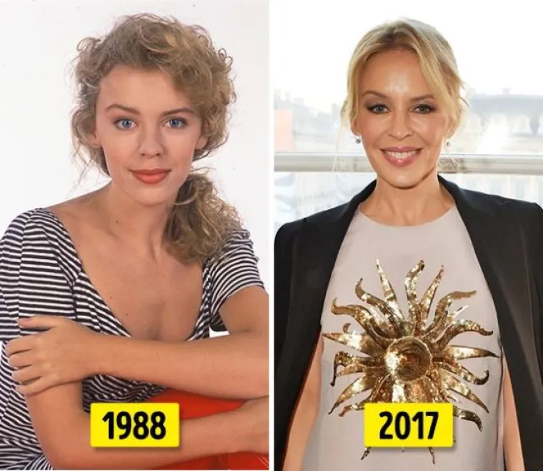 Kylie Minogue