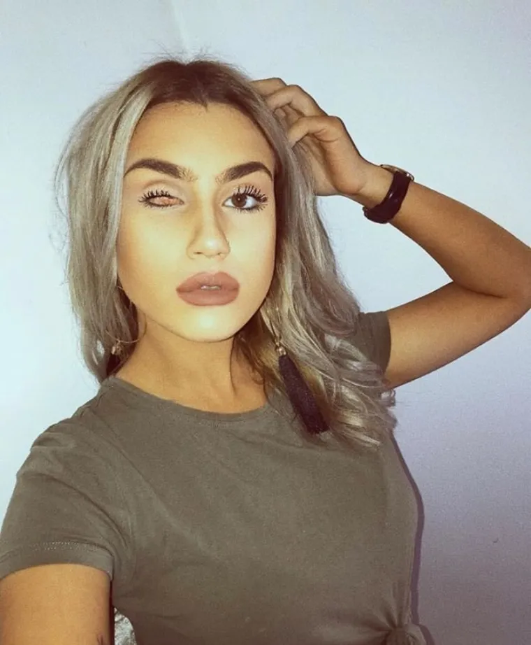 Njegovateljica Olivia Deane (23) iz Sussexa u Velikoj Britaniji dobila je 2008. strašnu dijagnozu - retinoblastom, rijetka vrsta raka u oku, koja obično pogađa djecu do četvrte godine života.