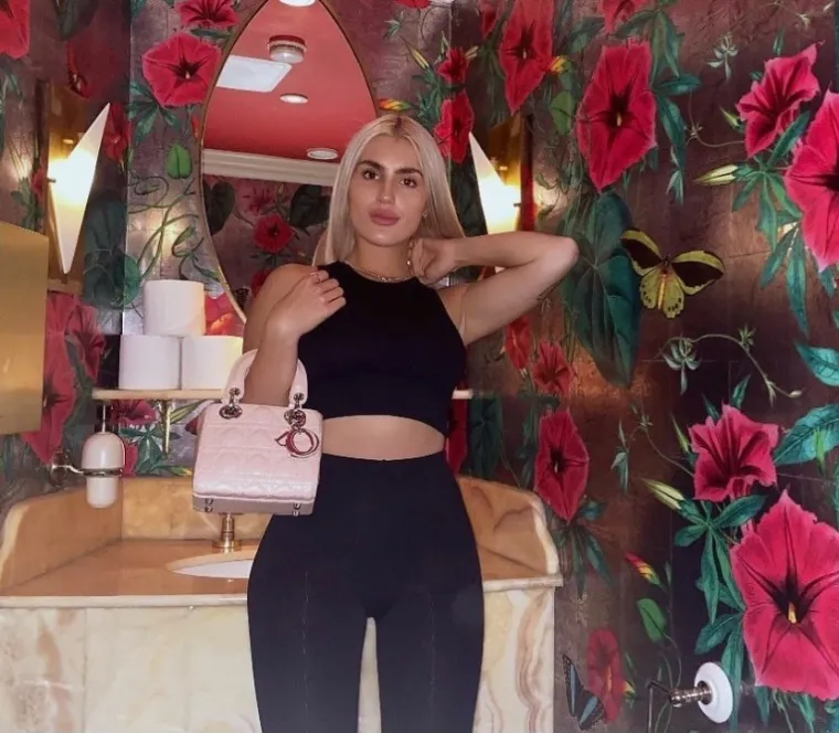 VIDITE LI NEŠTO NEOBIČNO NA OVOJ LJEPOTICI? Usprkos teškoj tjelesnoj mani, svi je uspoređuju s Kim Kardashian