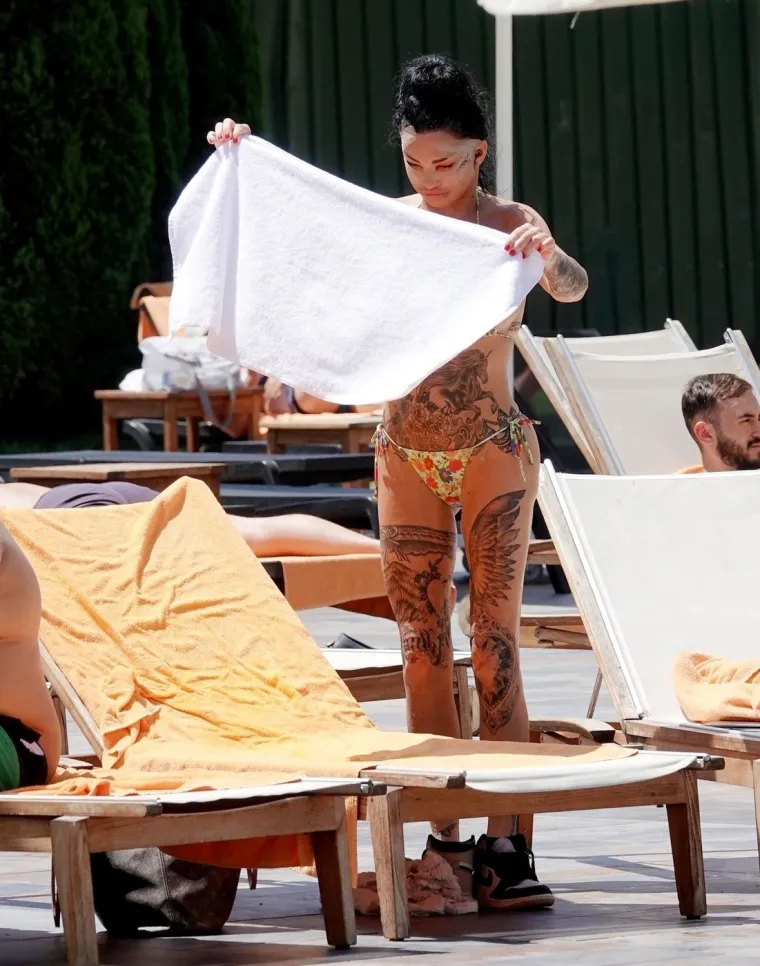 Britanska reality zvijezda Katie Price šokirala nakon operacije lica