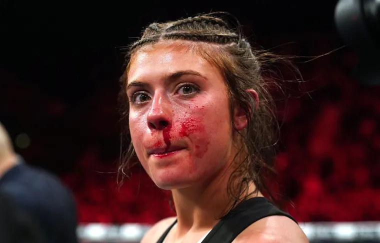 Bivša zvijezda filmova za odrasle serijom brutalnih udaraca pretukla i raskrvarila TikTok senzaciju