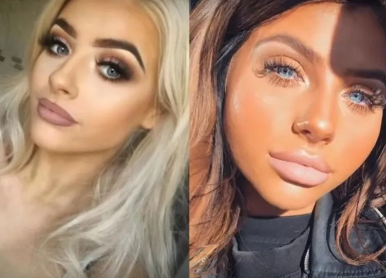 20 osoba koje su 'malo' pretjerale s plastičnim operacijama, njihove slike postale su viralne