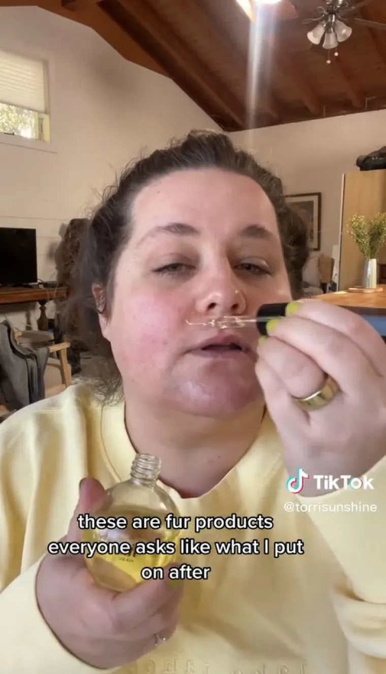 Torri je iskreno rekla: &quot;Dlake na licu su me uništavale i upravljale mojim životom, ali sada sam došla na drugu stranu kroz puno prihvaćanja sebe i rada na sebi. To me više ne definira niti upravlja mojim životom.&quot;