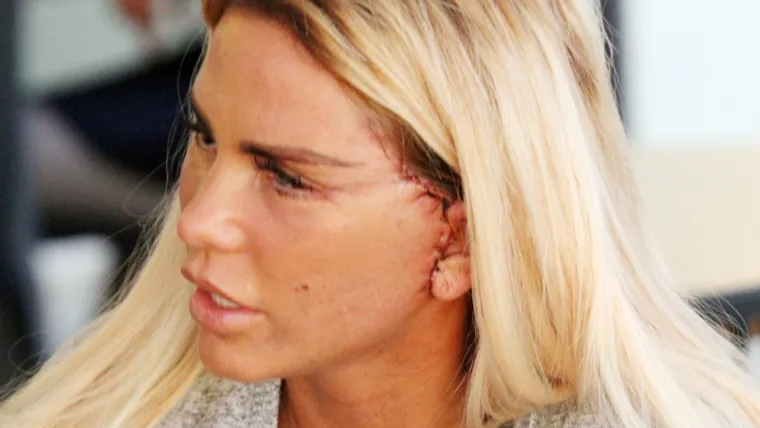 Katie je prvu estetsku operaciju napravila kad je imala 18 godina kada se podvrgla liposukciji, a povećala je i grudi. Nedavno se pohvalila da je po 13. put povećala svoje poprsje, a mediji su se sprdali s njom s natpisima da &quot;ima bove ispred sebe&quot;. No, ona se na to ne obazire, pa je nakon toga napravila još jednu liposukciju, tko zna koju u nizu. Katie je kroz desetljeća na sebi skoro sve korigirala ili povećala što se operirati dalo.