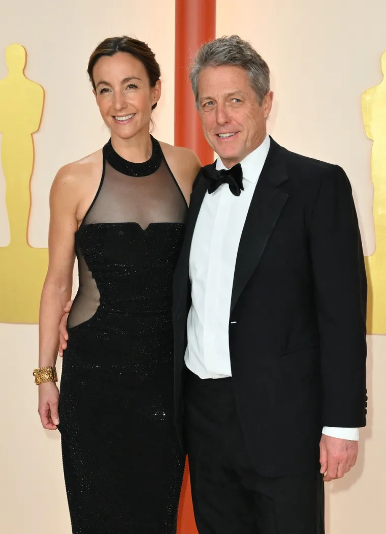 Kao da mu jedan incident nije bio dosta: Hugh Grant bubnuo da mu lice izgleda, ni manje ni više, nego kao skrotum