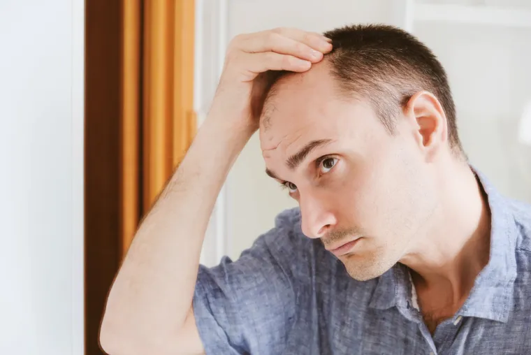 5. Stanjivanje kose: Hormonalne promjene također mogu imati neizravan utjecaj na vašu kosu zbog utjecaja na hranjive tvari u vašem tijelu. Ponekad stanjivanje i ispadanje kose može biti uzrokovano iscrpljivanjem zaliha hranjivih tvari u tijelu. Tijekom perimenopauze, ženama su mjesečni ciklusi češći ili gušći, što može smanjiti razinu željeza. Taj nedostatak željeza rezultira padom razine feritina, proteina u krvi koji skladišti željezo, i manjkom crvenih krvnih stanica koje se stvaraju za prijenos kisika po tijelu. 