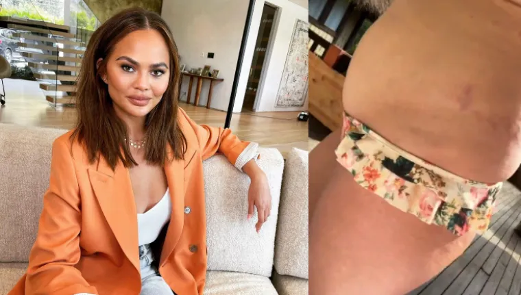 Chrissy Teigen i njezin suprug, glazbenik John Legend, 2018. dobili su drugo dijete i to sinčića, a manekenka je sretnu vijest objavila videom na kojem pokazuje svoje tijelo nakon poroda. &quot;Netko je došao&quot;, napisala je.