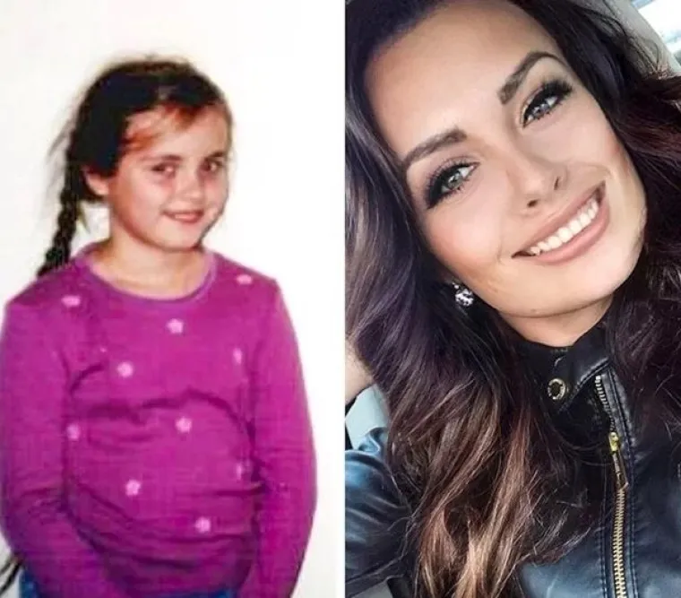 Puberty gone right: Ovo su najbolje transformacije koje ćete danas vidjeti