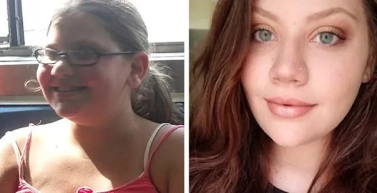 Puberty gone right: Ovo su najbolje transformacije koje ćete danas vidjeti