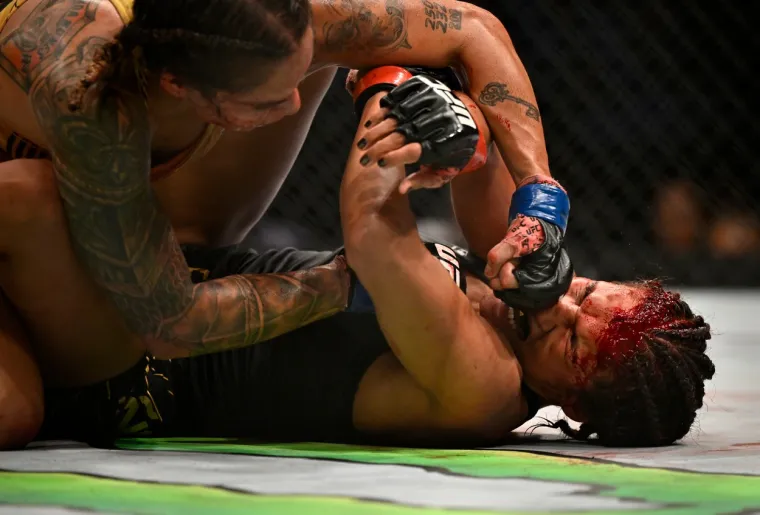 UFC borkinja završila kod plastičnog kirurga nakon užasne ozljede: 'Ostala je bez velikog dijela glave'